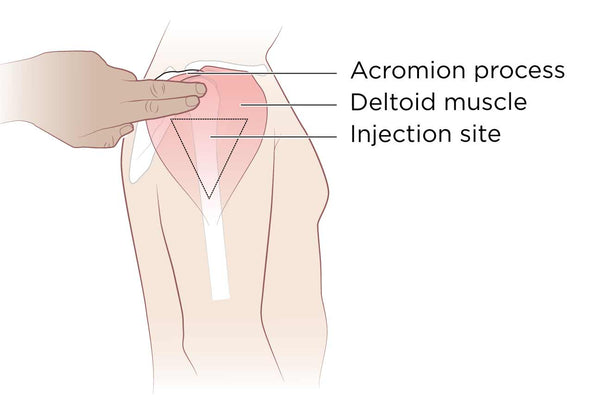 Intramuscular (IM)  Injection Training Model